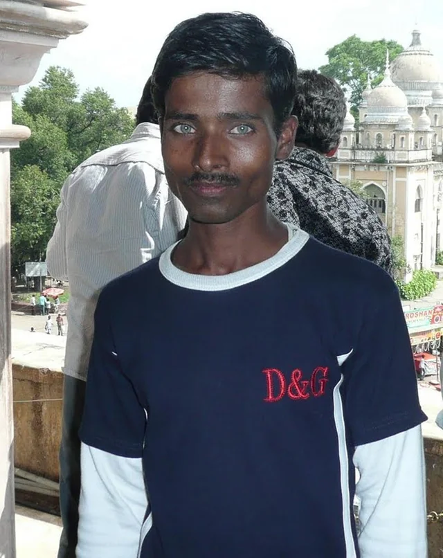 Unknown guy with unique phenotype v0 0gald0tdih4c1