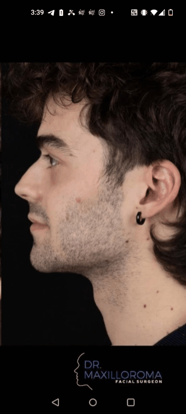 GIF 20251210 154354 555