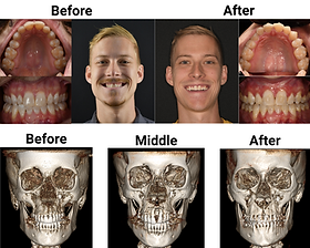 Sam Franklin Before and After