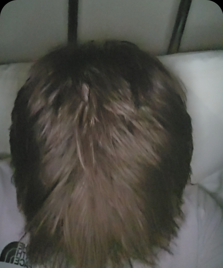 1000091660