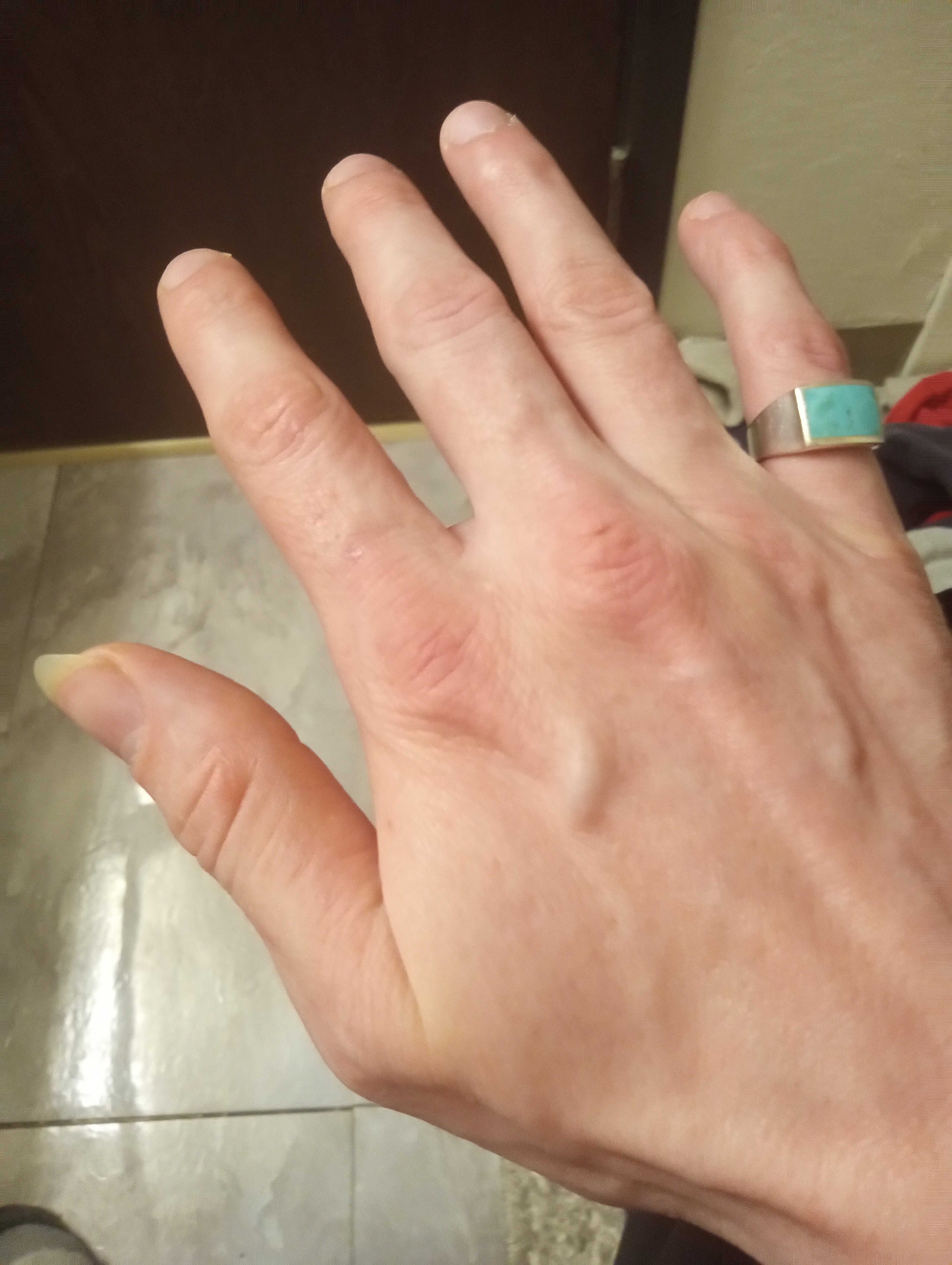 IMG 20251212 214618595