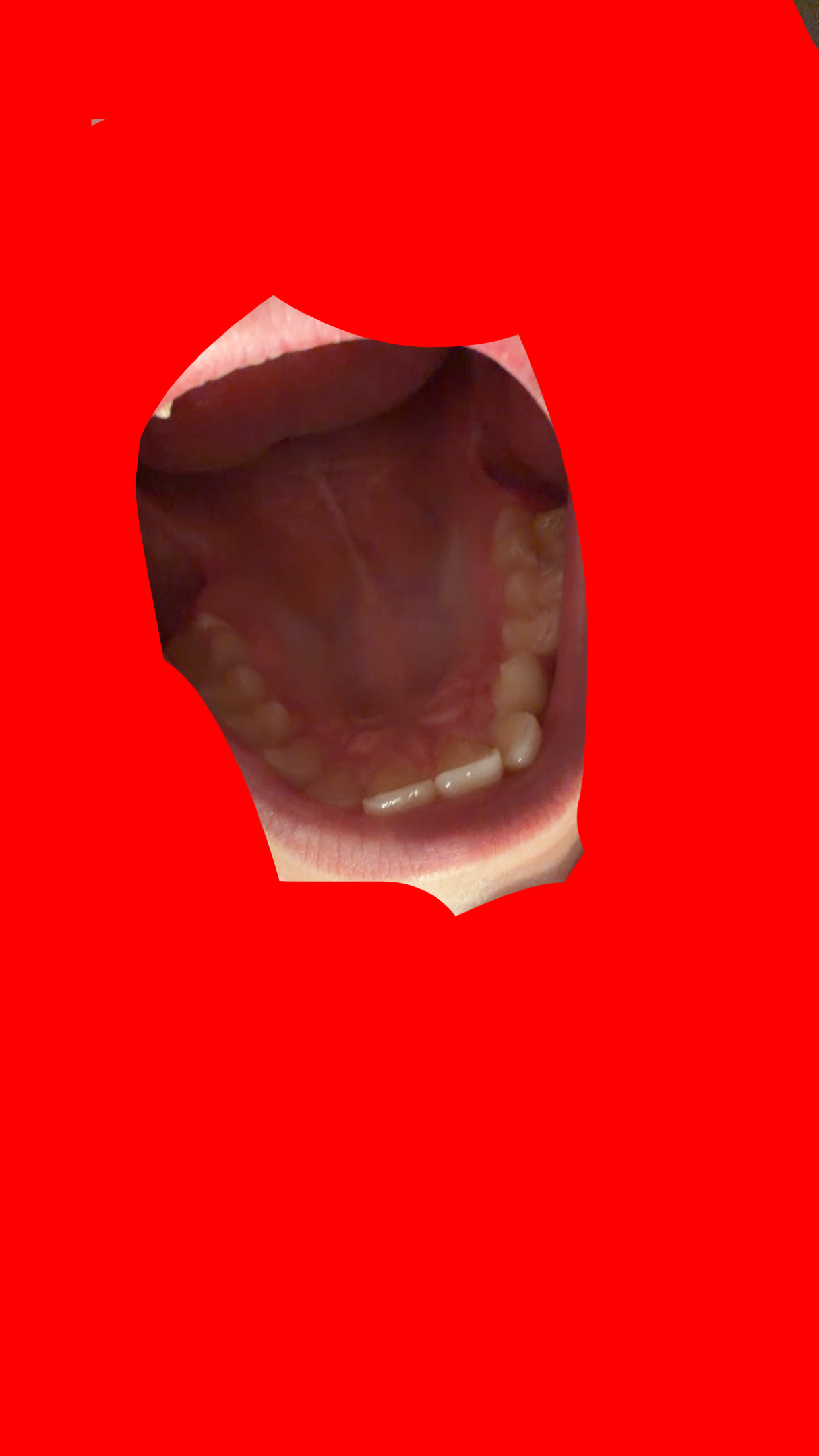 IMG 3933