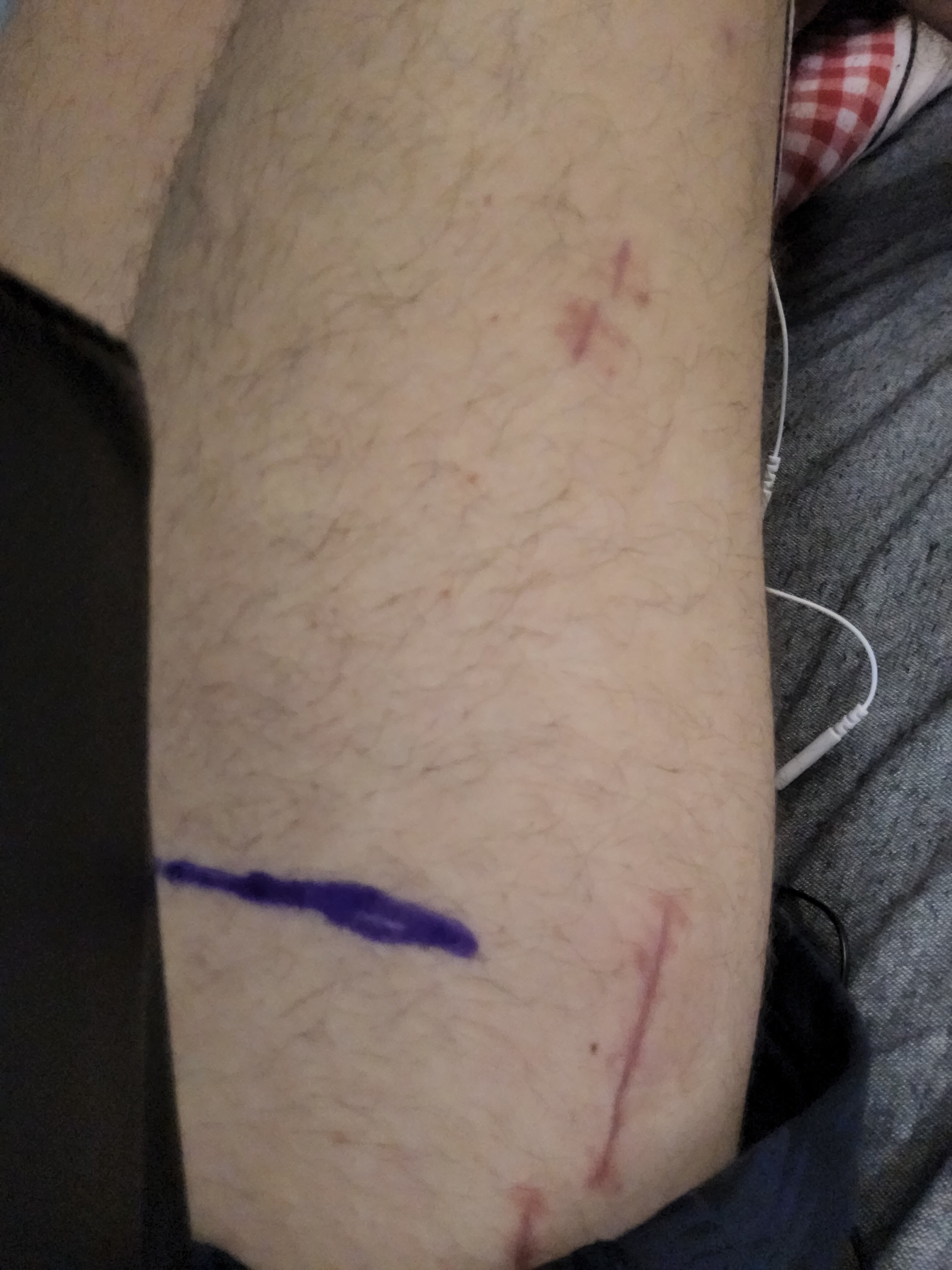 17656542073432712620941819178610