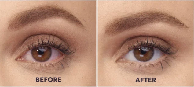 Slider img1 e1678171627526