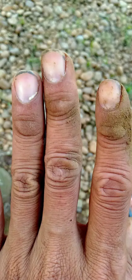 Dirty fingers long nails 249463415