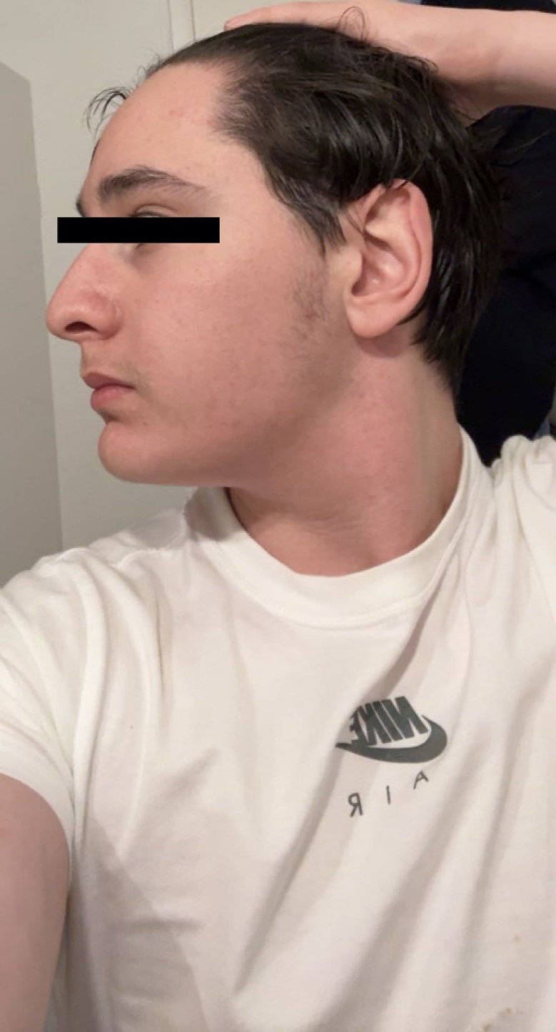 BF8808C4 848B 4883 8DB2 12F362DBACCD