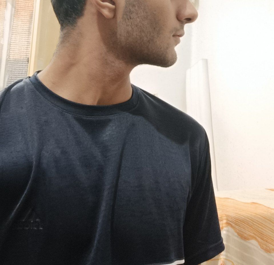 1000131844