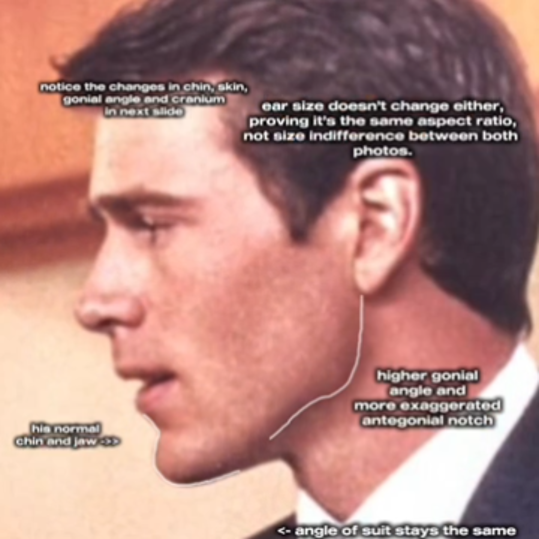 New Project 5 993FE25