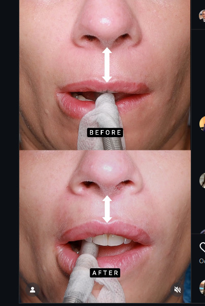 646F761F 40B2 4DED AC3A C8FF83EA3968