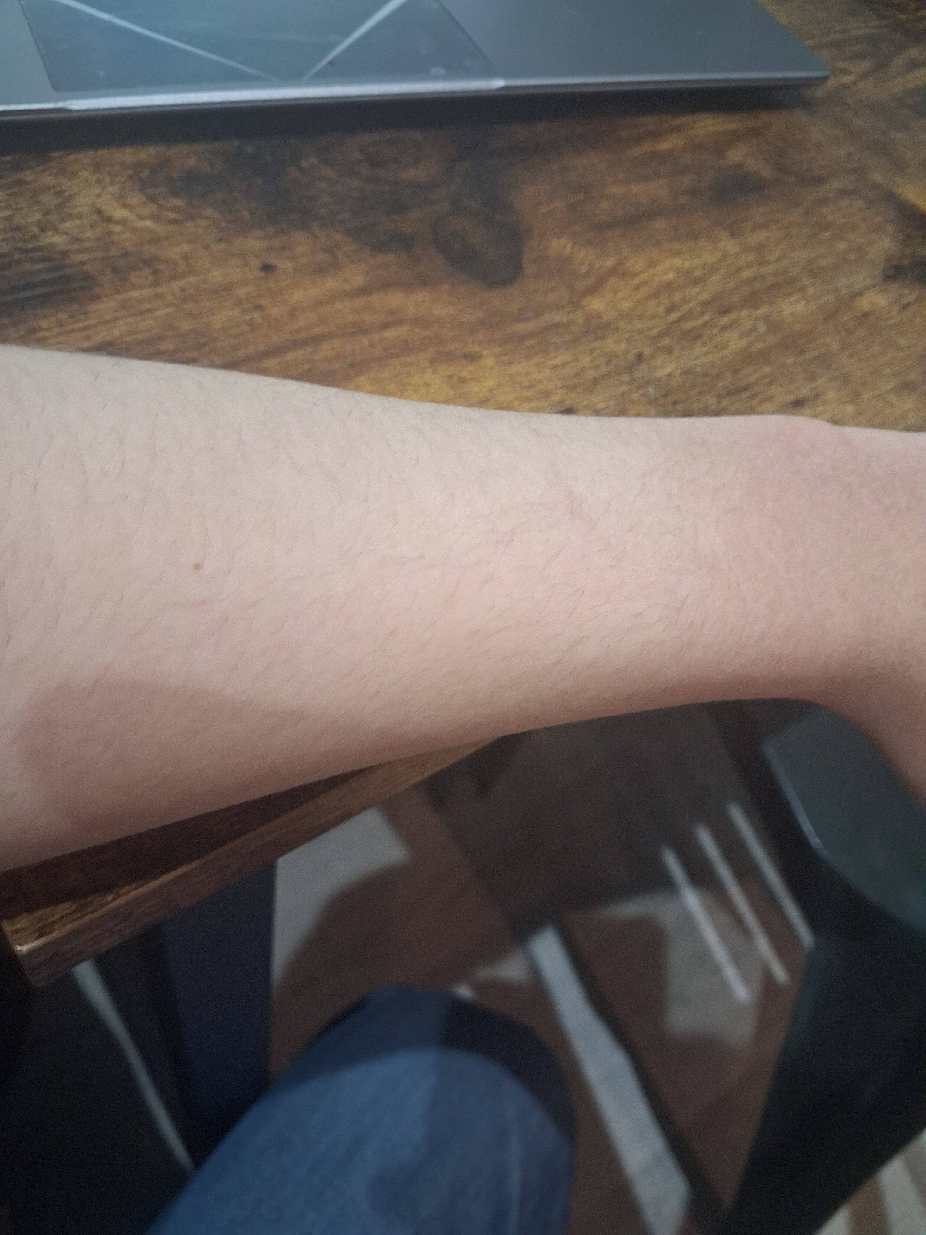 17665022246018212864241976203490