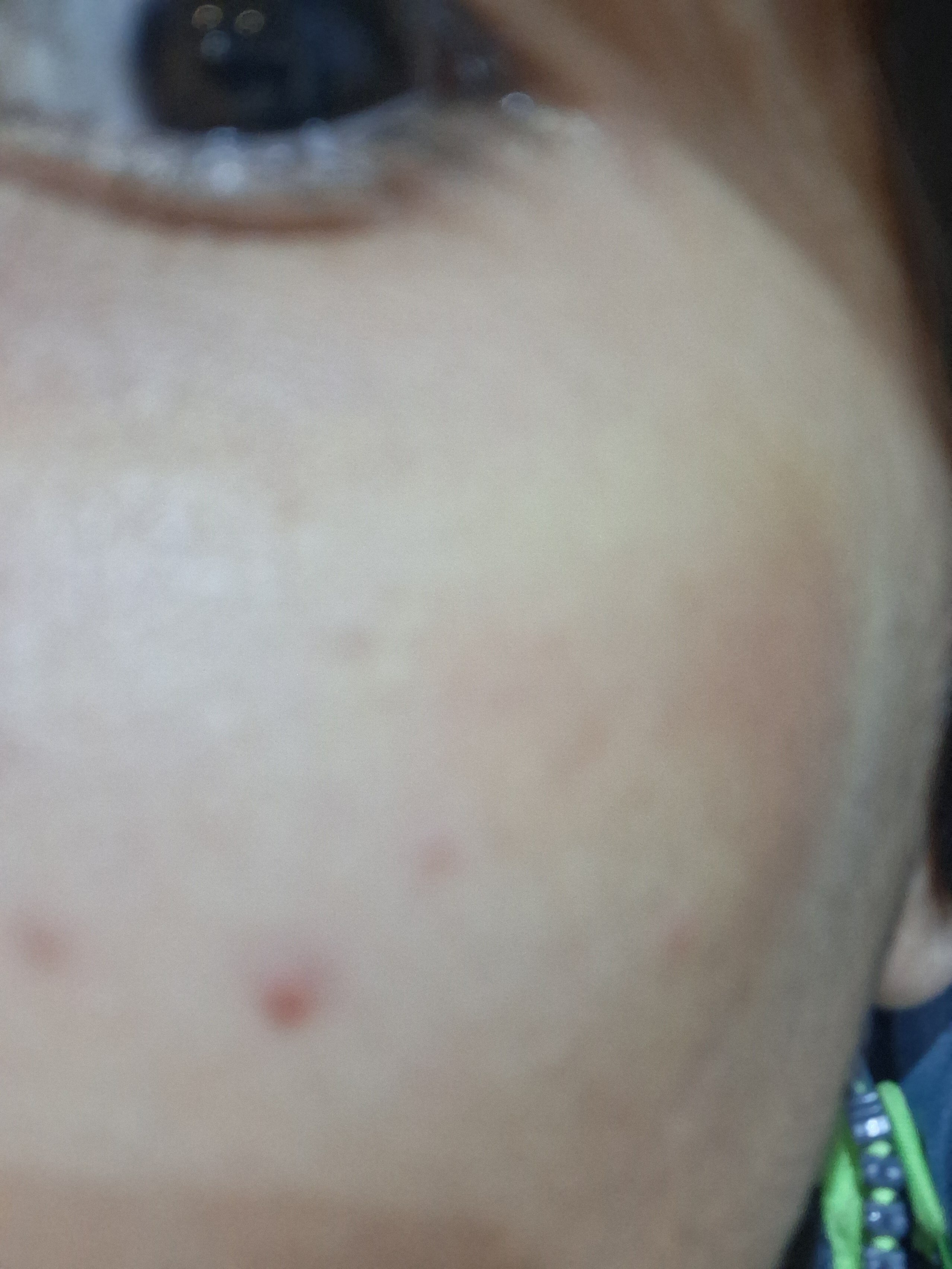 17665273839164964644052760593085