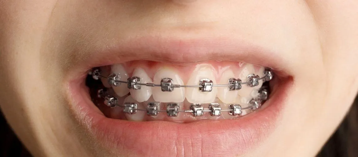 S2 8 qqv6m3aktvvo2ujektmx1hju0au79q4vjxdc3j1pxk