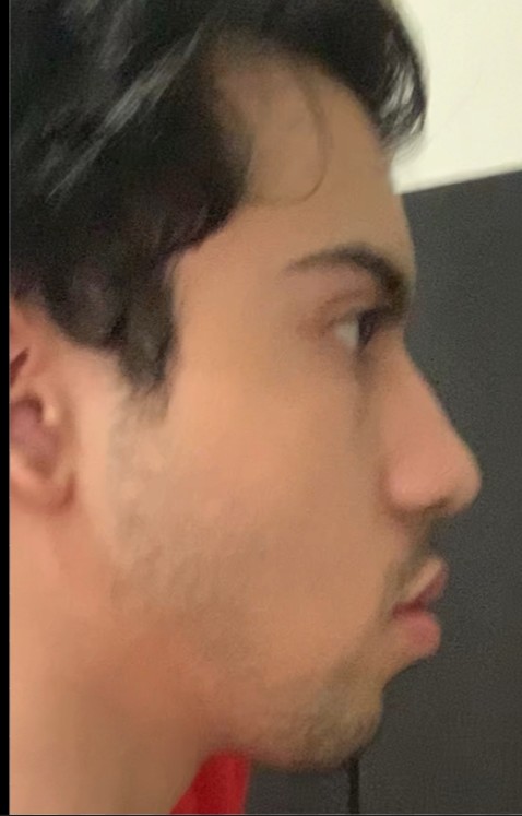 Screenshot 20251225 044007 Free Adblocker Browser