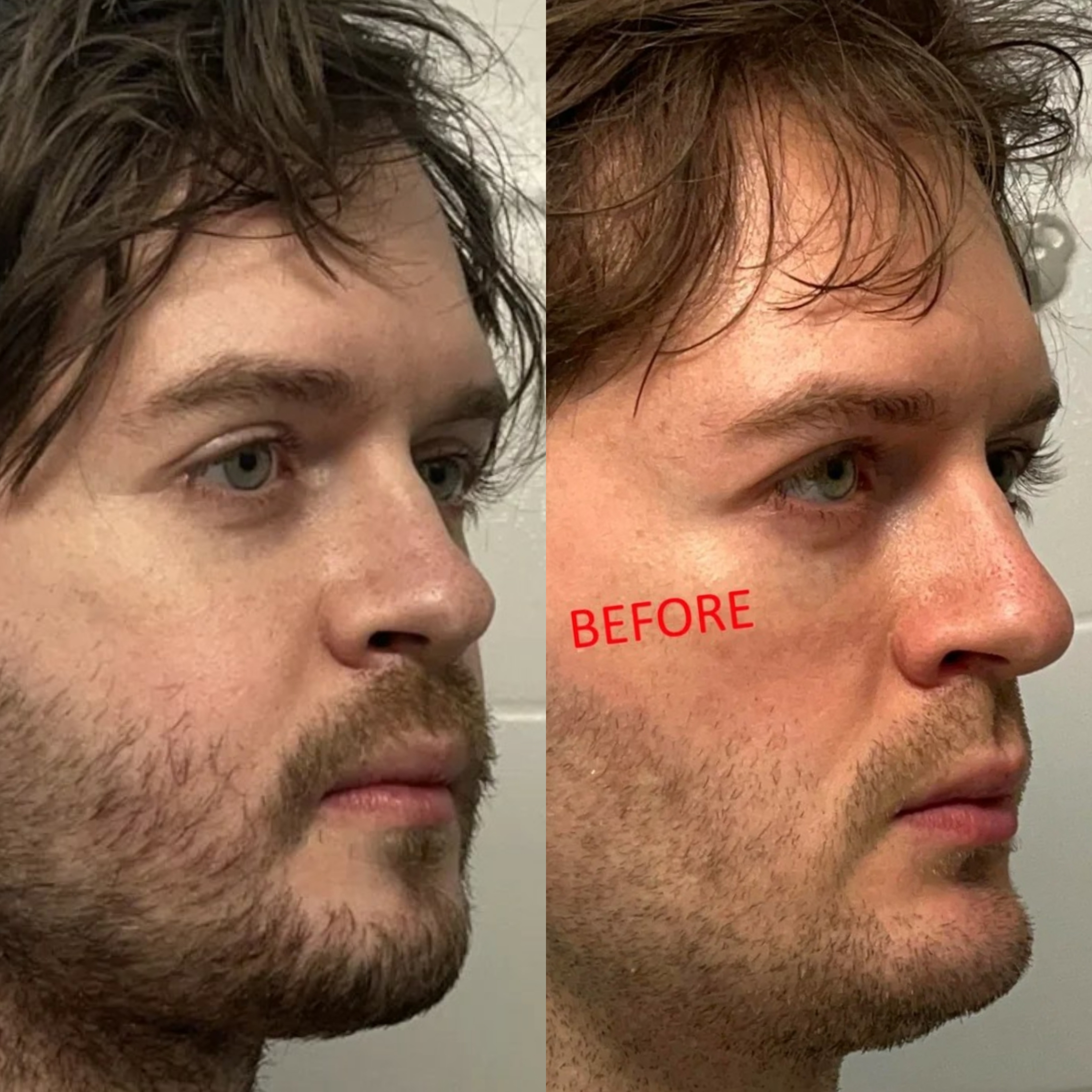 B612 20251225 113022 992