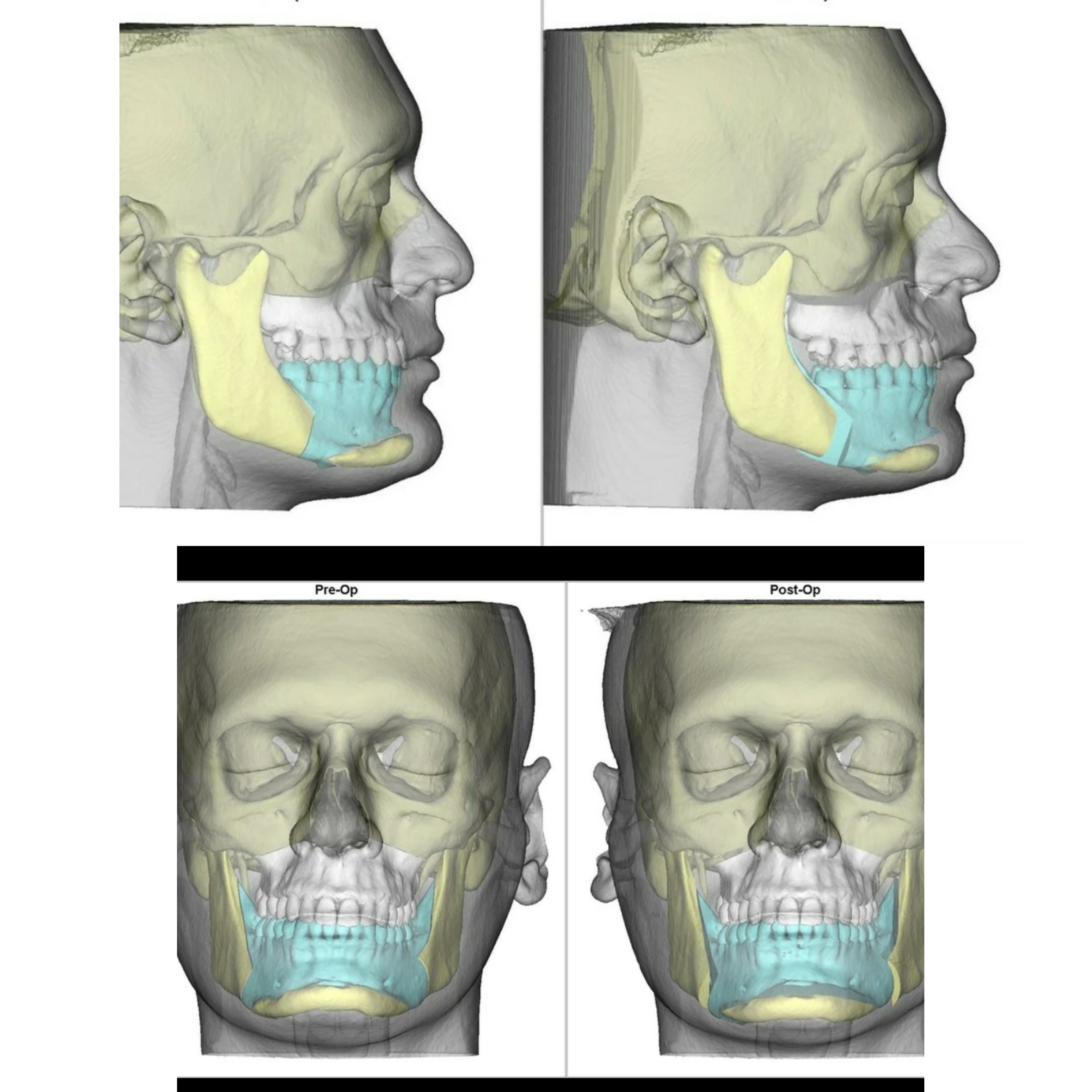 B612 20251225 120520 724
