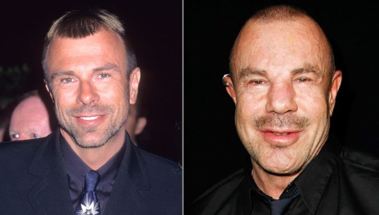 Thierry mugler chirurgie esthetique photo avant apres 1