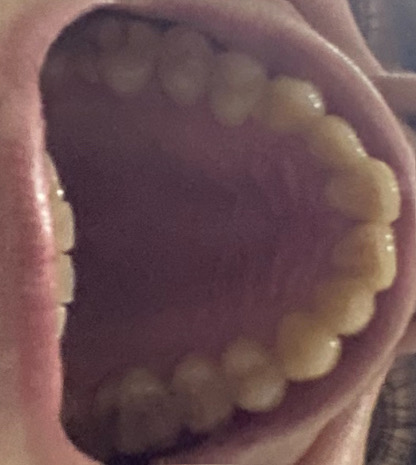 87B52183 81E1 4954 A476 B3DD1AA4CE29