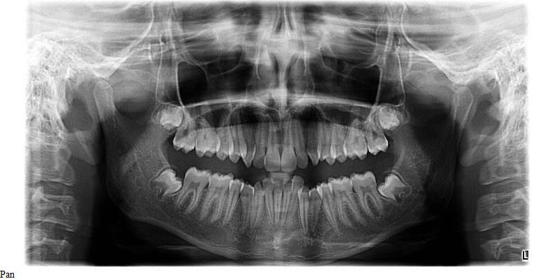 Anagh Bhavsar Pan 1 edited copy