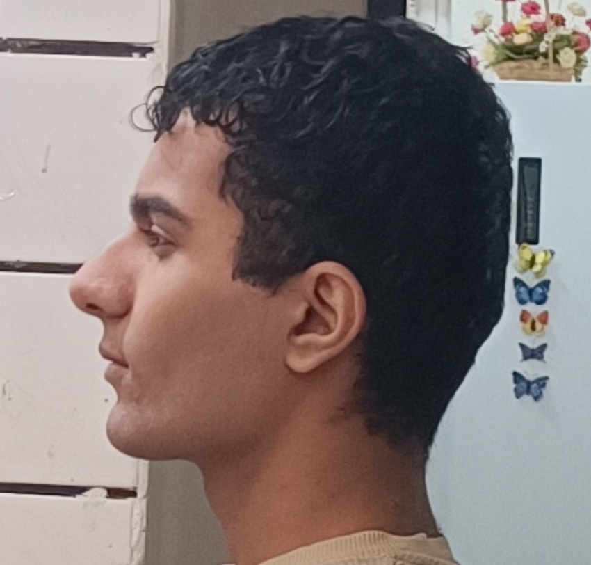 1000132816
