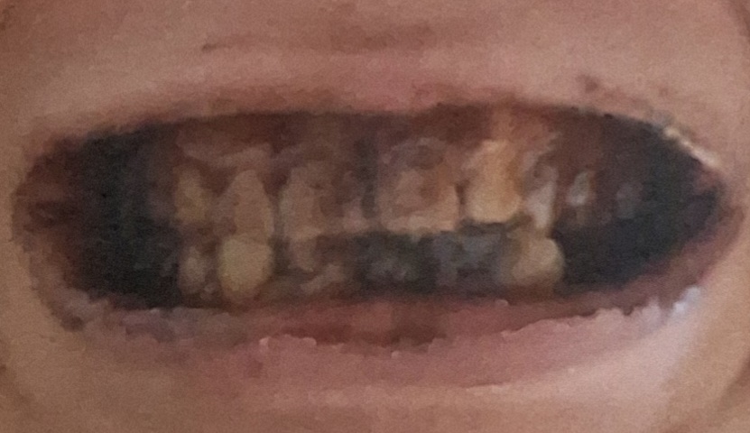 20251212 075231