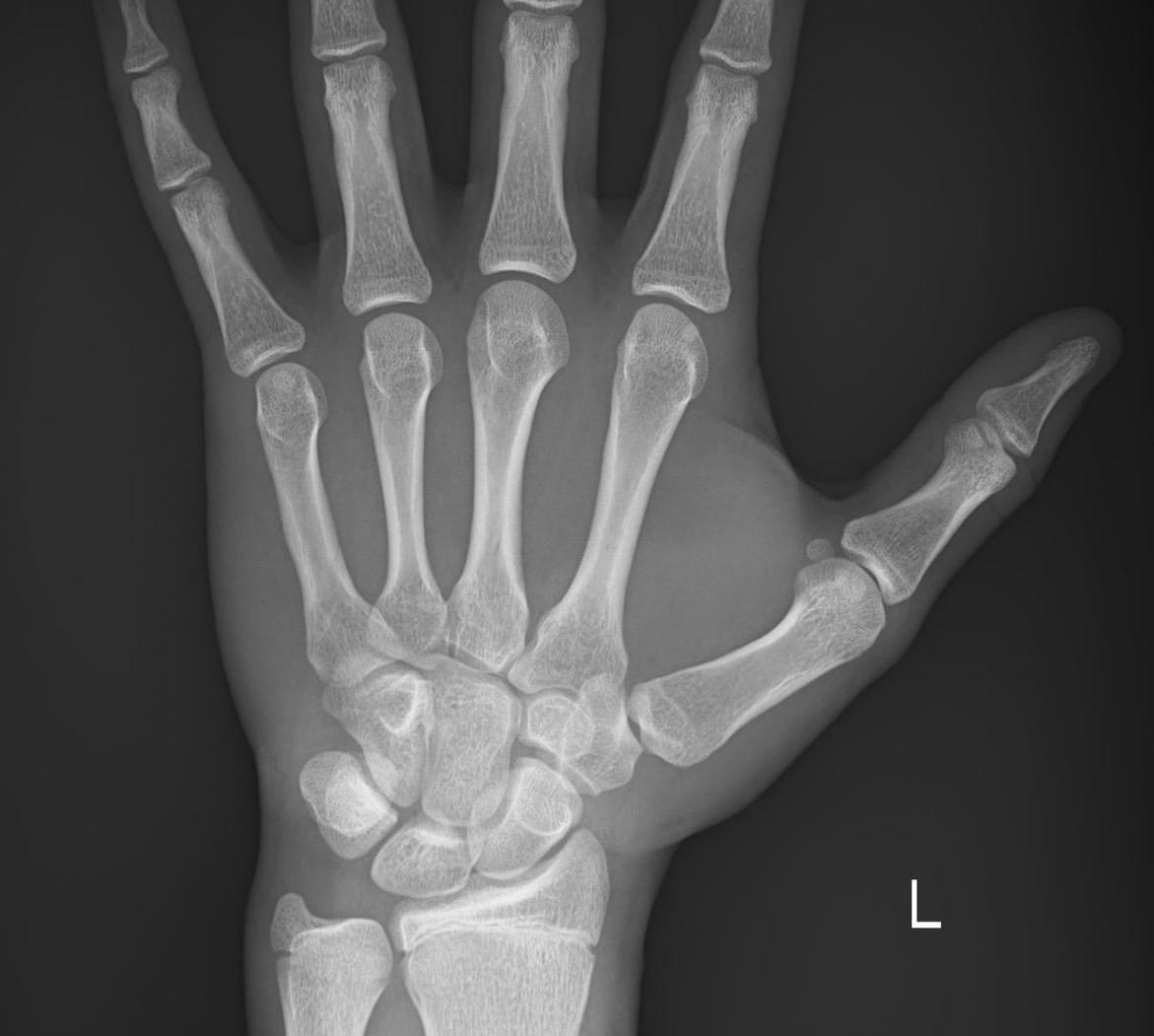 Afb79647 56d1 4d9a a86d 8dcc5dab5c39