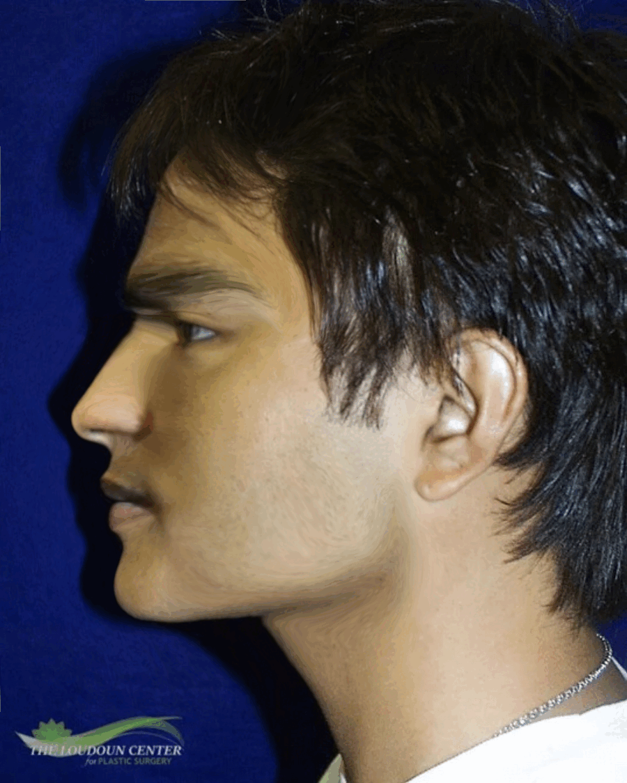 Ezgifcom animated gif maker