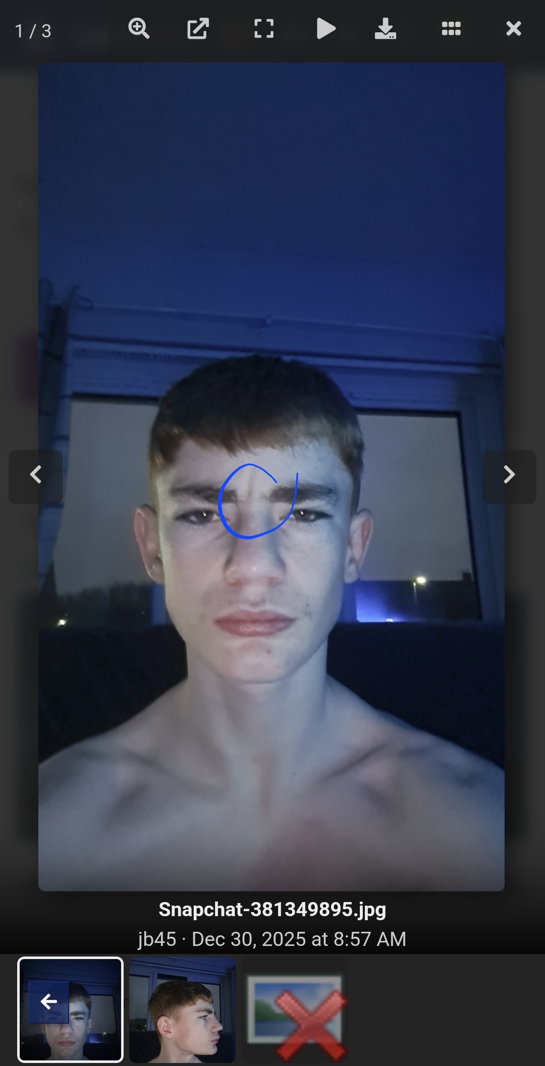 1000038170