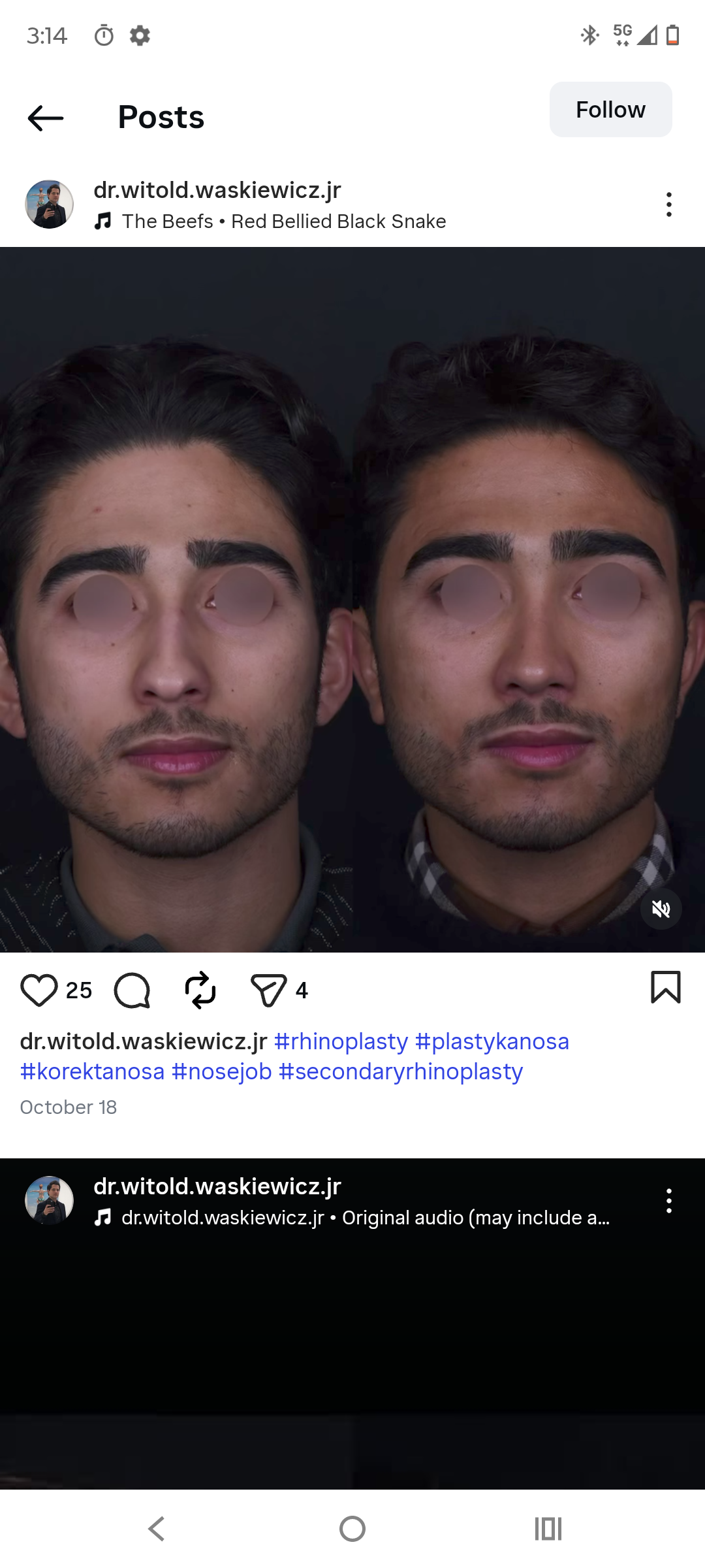 1000007752