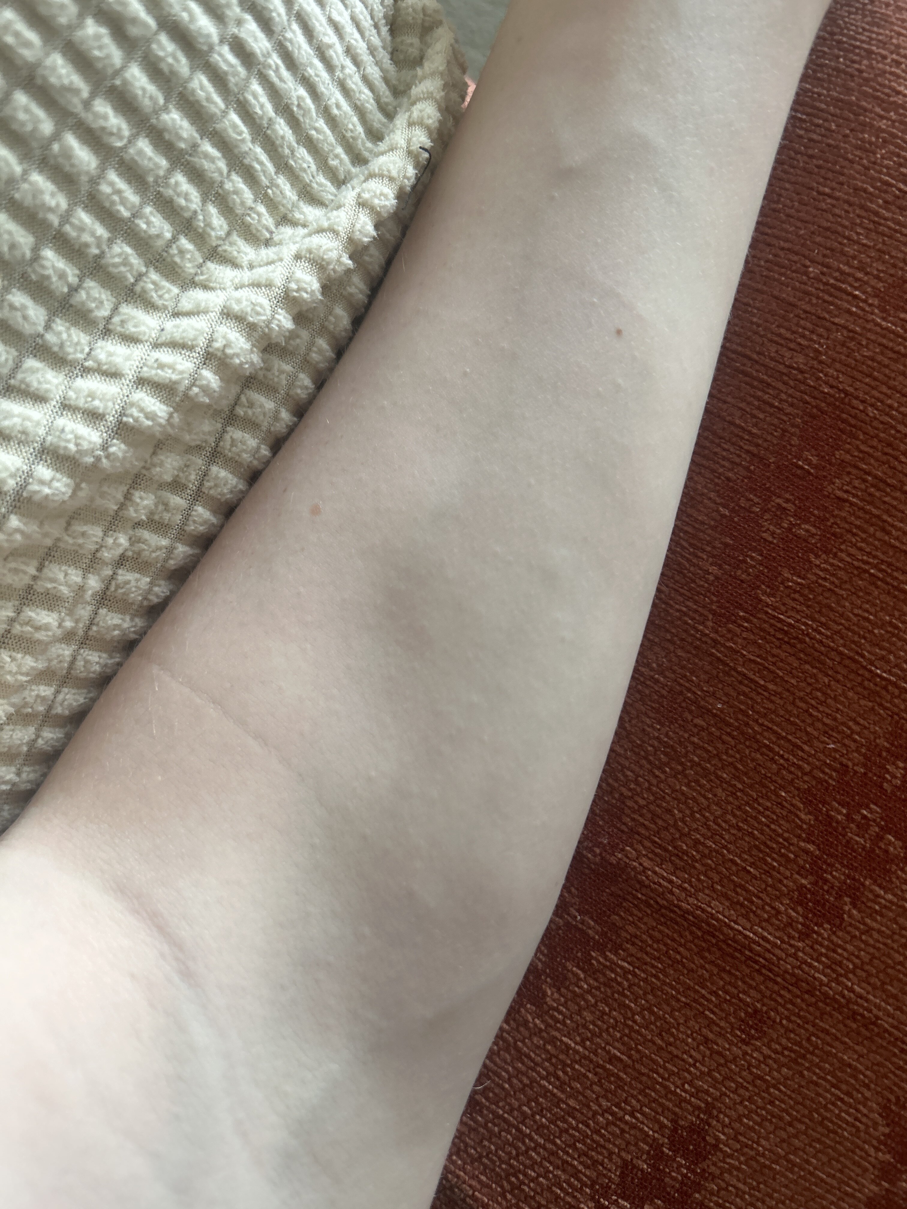 MySkin