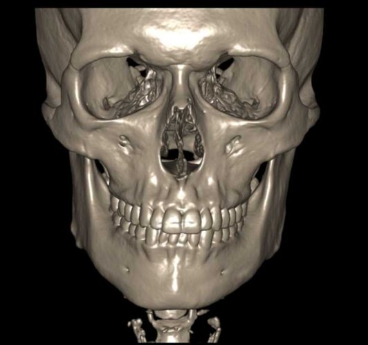 Screenshot_20251201_160340_My Xrays.jpg