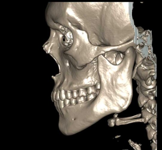 Screenshot_20251201_160334_My Xrays.jpg