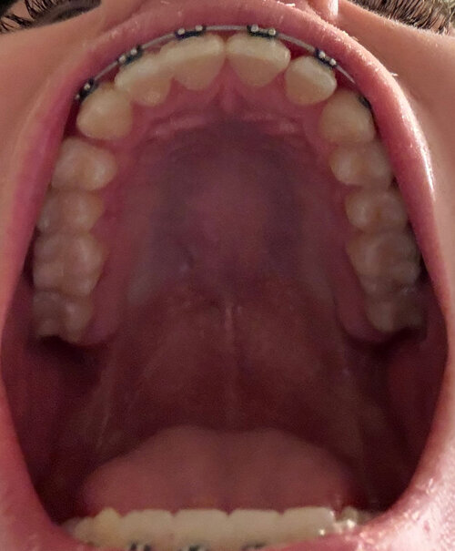 409092953 971282834 IMG 1857  1 