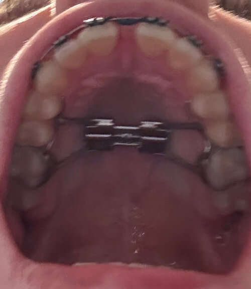 238668319 251985025 IMG 1625  1 