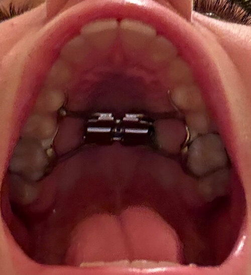 675703677 202619655 IMG 1606  1 