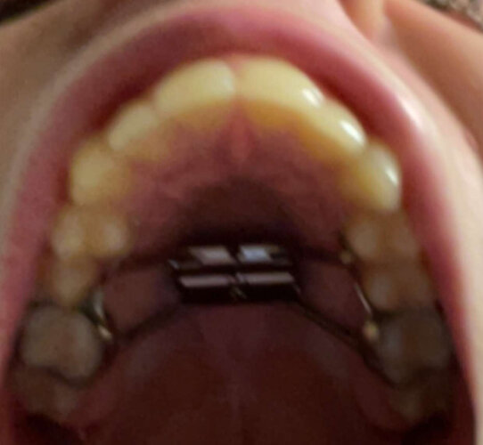 209150240 915988782 IMG 1597  1 