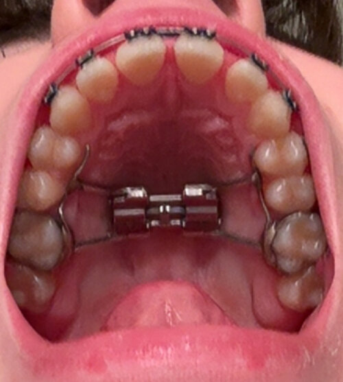 753375862 292799500 IMG 1632  1 