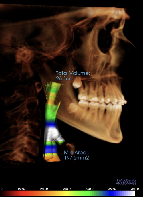 Screenshot 2025-12-02 at 17.31.46.png