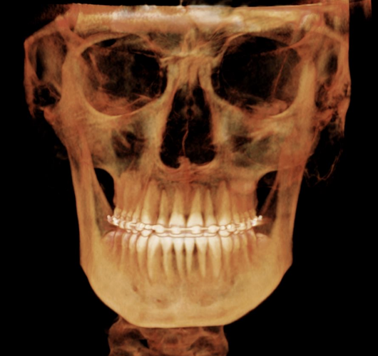 Screenshot 2025-12-02 at 17.32.00.png