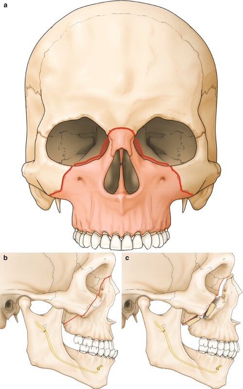 480405 1 En 6 Fig2 HTML