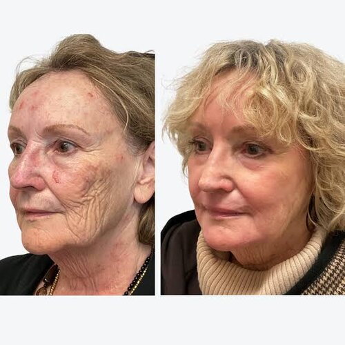 images (2) (12).jpeg