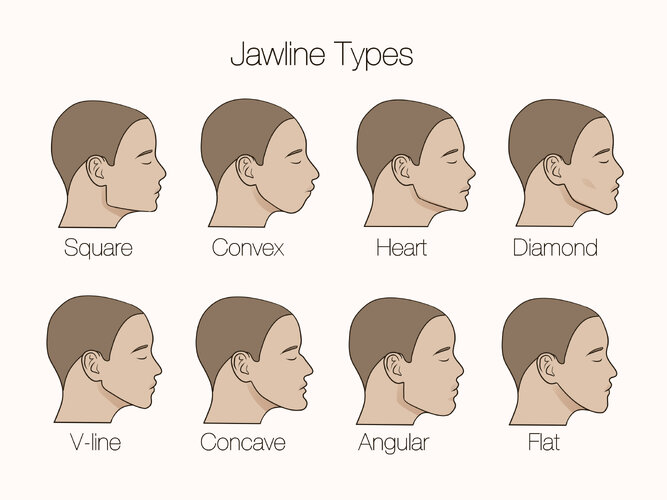 Types-of-Jawlines-Summary.jpg