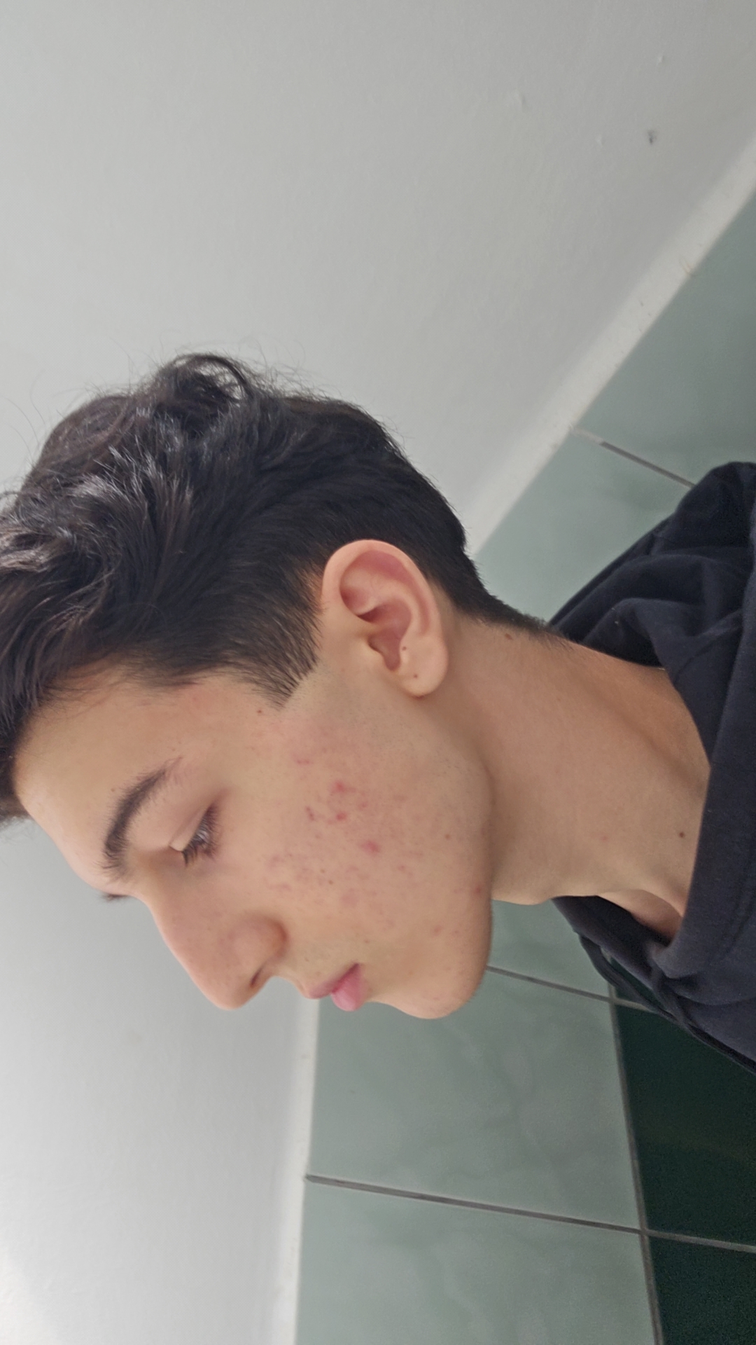 1000017464