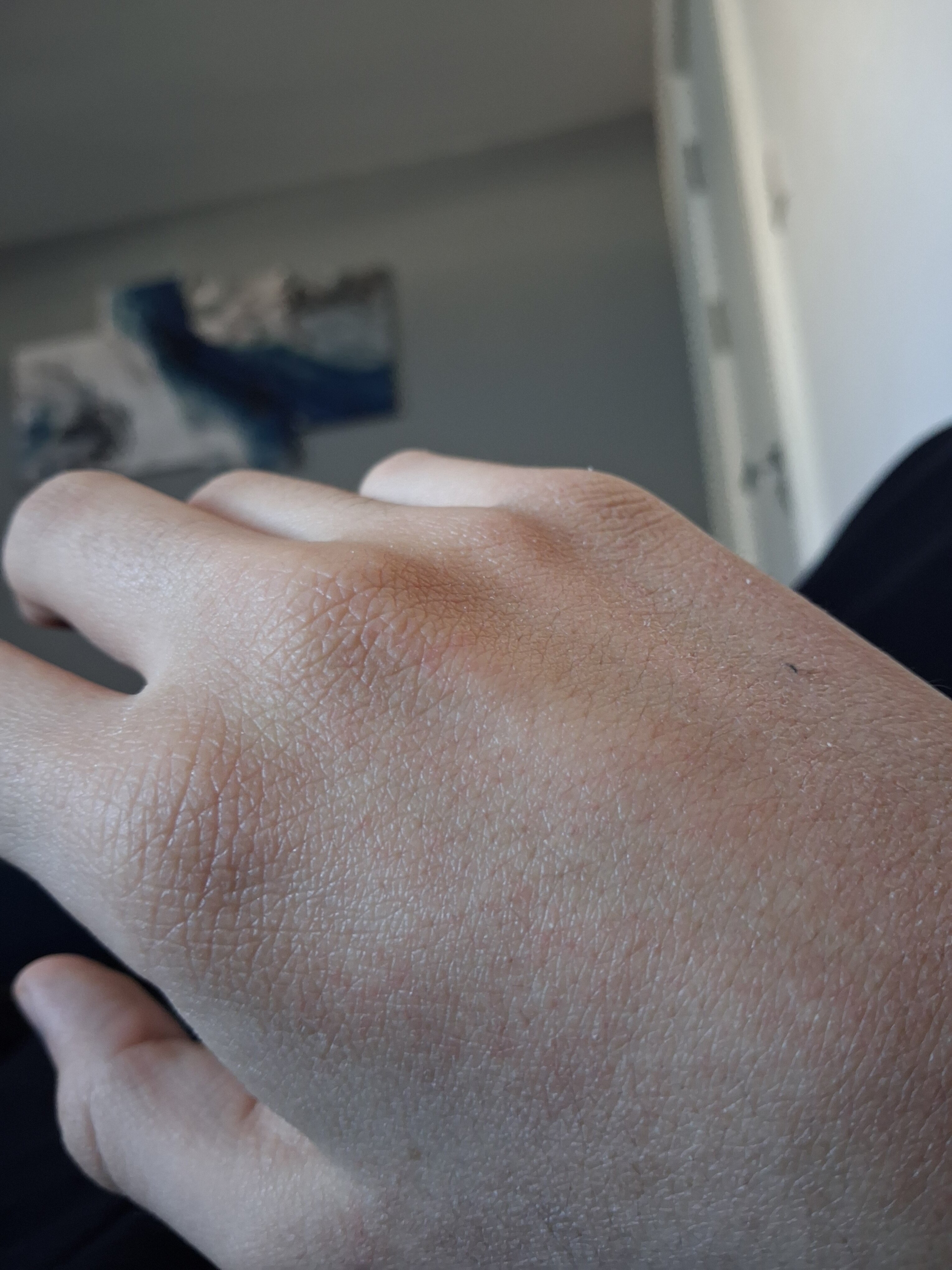 17673588490766488728296035571728