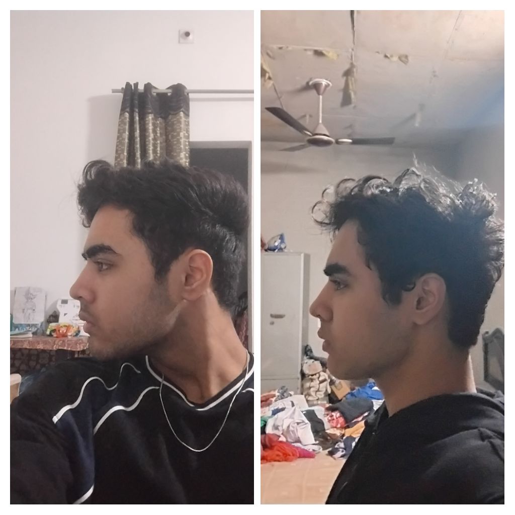 1000039944