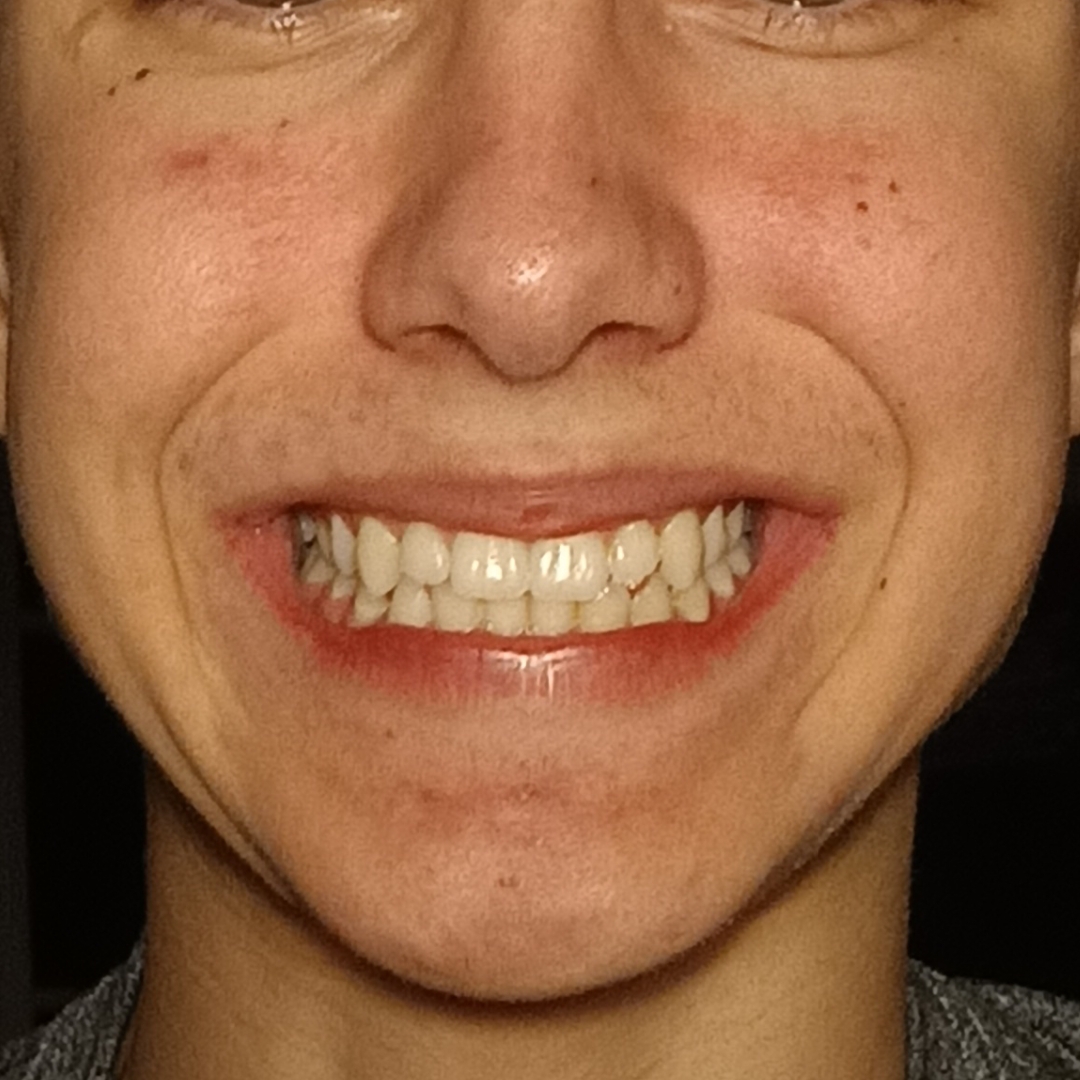 Screenshot 2026 01 03 23 22 39 405 commiuigallery edit