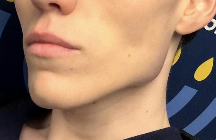 B35BC10F 5BD5 4037 8D8E 65E026101E4F 1 201 a