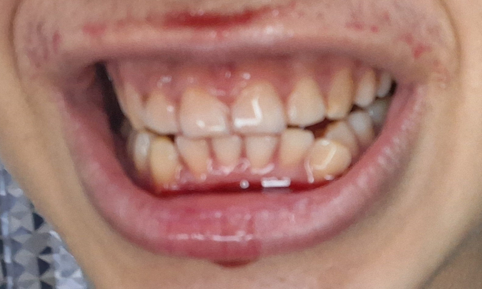 20260105 113851