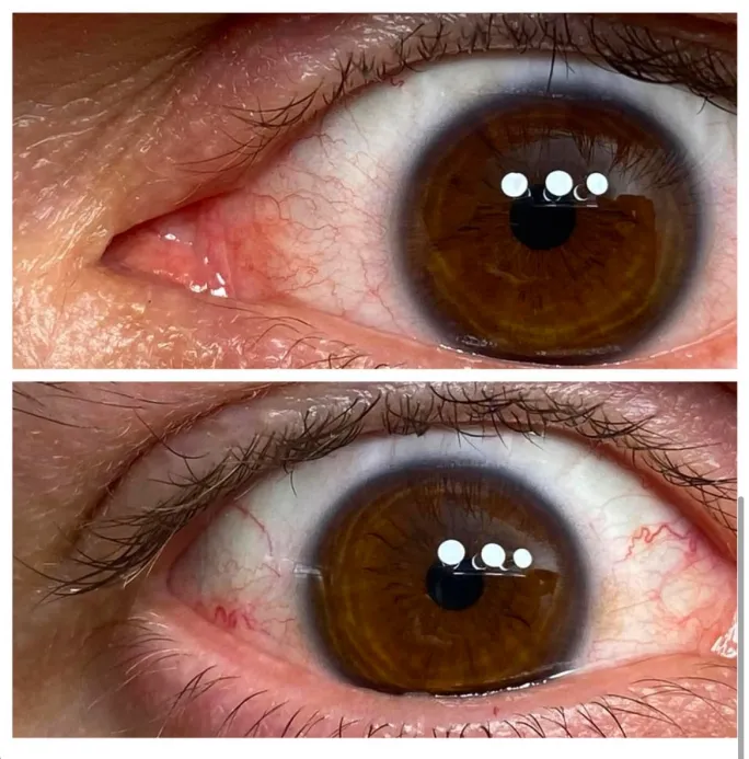 87E7D15D 4BDE 4133 89AF 52C8110F73E8