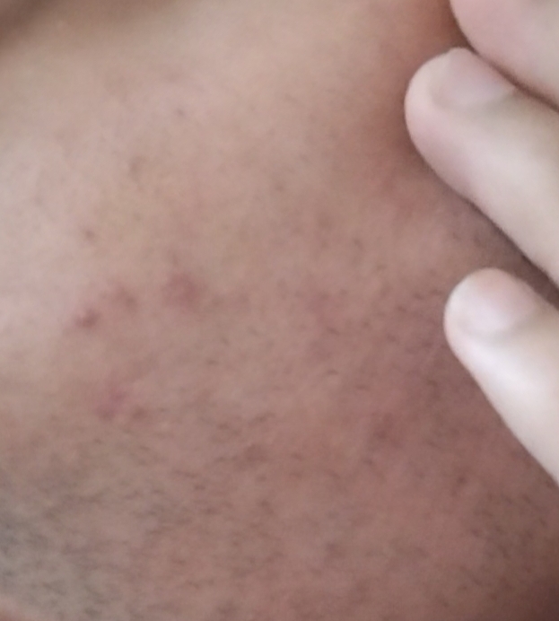 Screenshot 2026 01 06 22 18 35 786 commiuimediaviewer edit