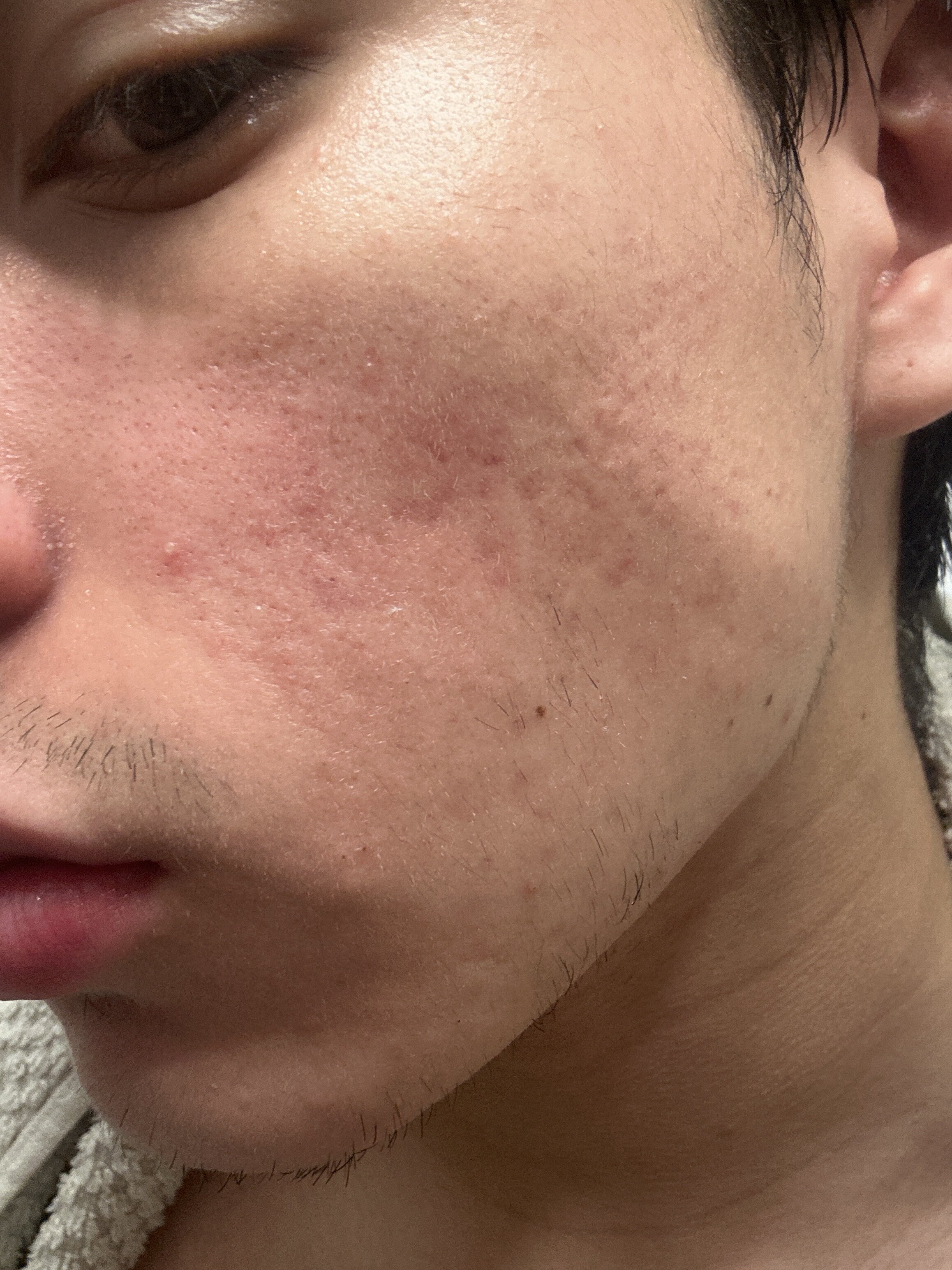 IMG BF30AD2E E6F9 4652 A1C8 23DD1D2EF699